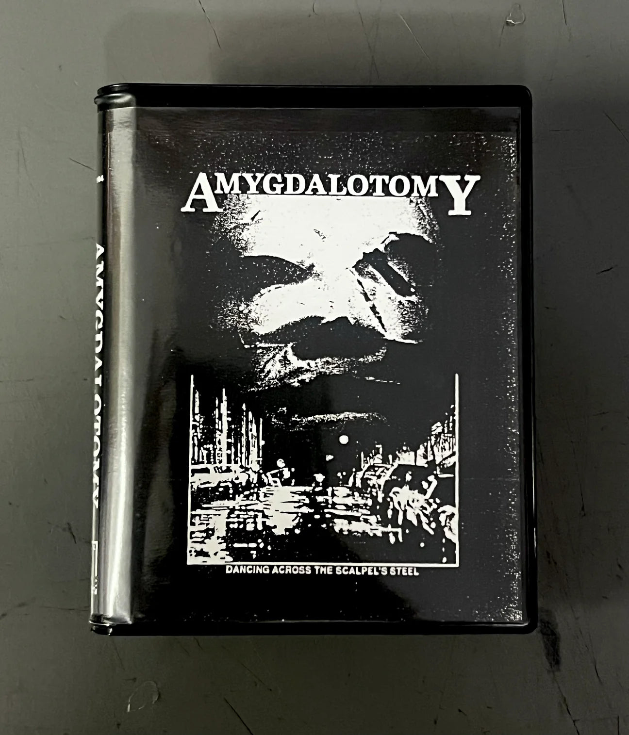 Amygdalotomy - Dancing Across The Scalpel's Steel CS